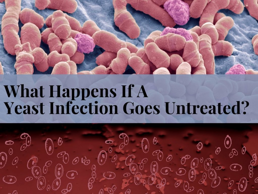 What Happens If A Yeast Infection Goes Untreated? Complications And Mangement